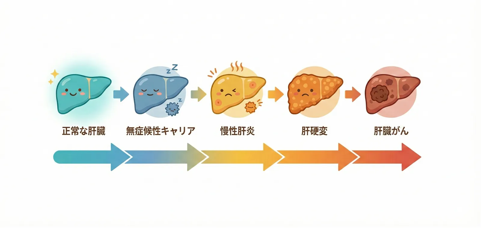 B型肝炎進行モデル